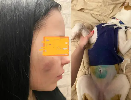 В Свердловском районе Красноярска мужчина избил девушку мобилизованного и ее 6-месячного щенка. Фото: sibnovosti.ru.