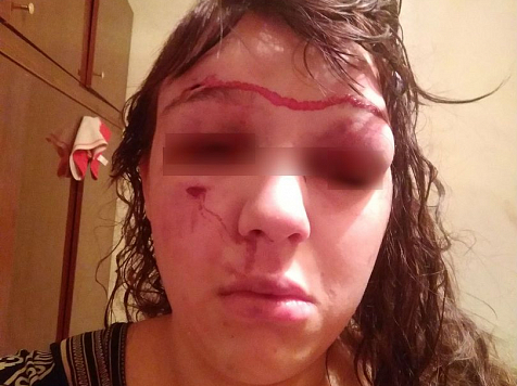 Стали известны подробности зверского избиения молодой матери в Лесосибирске. фото: «ЧП Лесосибирск»