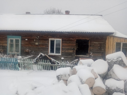 В Красноярском крае 2-летняя девочка умерла от ожогов