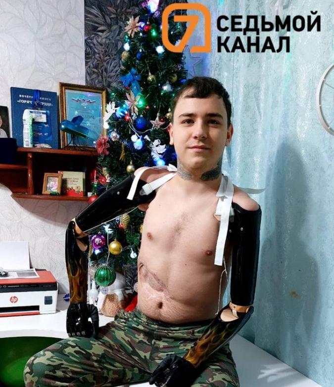 Красноярский подросток без рук наконец-то получил новые протезы