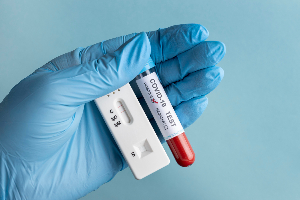 hand-with-protective-gloves-holding-a-blood-sample-for-covid-test.jpg