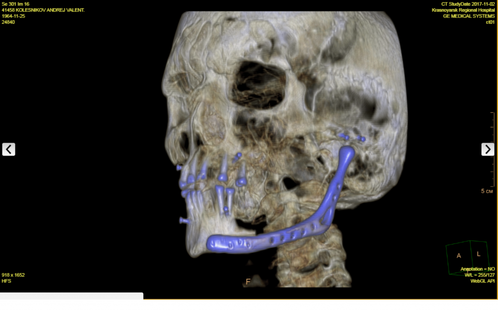 колес 6.png колес 6.png