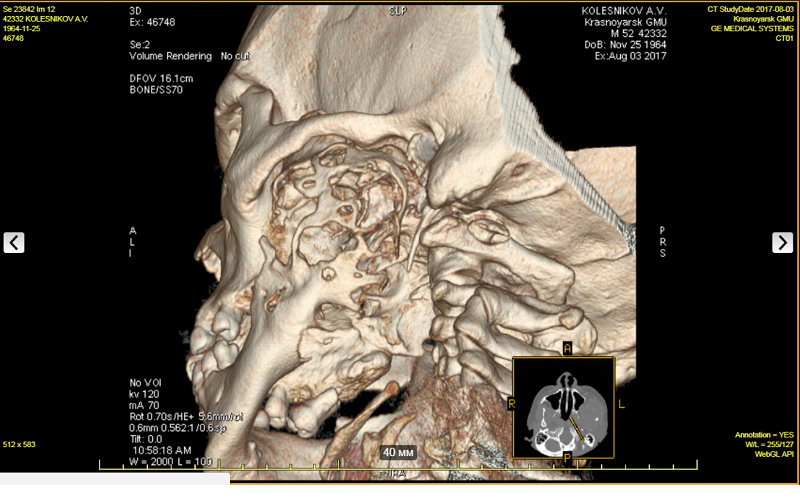 колес1.png колес1.png