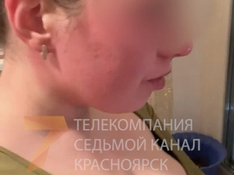 В Красноярске парень залил лицо бывшей девушке перцовым баллоном. видео: «7 канал Красноярск»