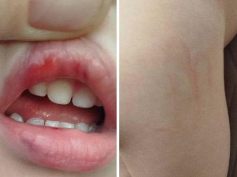 Воспитателя красноярского детсада обвинили в применении насилия к ребенку. Фото: Межрегиональный центр по правам несовершеннолетних