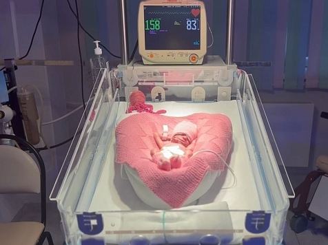 В Красноярске родилась крохотная девочка с весом всего 790 граммов. Фото: Центр охраны материнства и детства