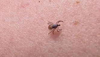 Первые случаи клещевого энцефалита зафиксировали в Красноярском крае
