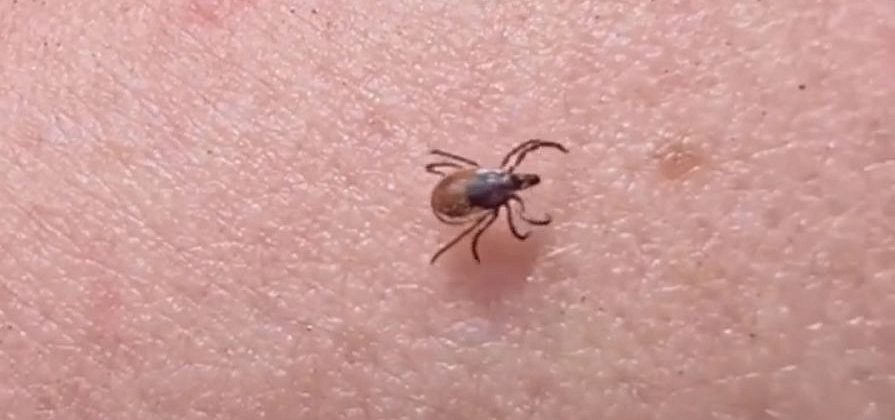 Первые случаи клещевого энцефалита зафиксировали в Красноярском крае