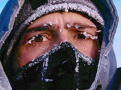 За неделю 37 жителей Красноярского края госпитализировали с обморожениями . Фото: <a href="http://yandex.ru/clck/jsredir?from=yandex.ru%3Bimages%2Fsearch%3Bimages%3B%3B&text=&etext=9170.dKR-h-ONSJCiYhb8wxAoMayrktTveJiUp95E5Wk9VlGITgttbtRfmTlLU_QTGuD72zR5UyhqHrsRPAx74Tnfgg.cd1bd8130a2981f19d7aeb1719dd57c6511c759a&uuid=&state=iric5OQ0sS1mPitaa3mxJE61AVKS1Y9siPMmVFsWPIWEtrEgMmapww,,&data=eEwyM2lDYU9Gd1VROE1ZMXhZYkJTWlQ1TGdYUlhSakJUNHFvQ2Zxd2UzR1lxZ3lqSFZjQk1hUjJIRl9kNy1iWUVITGxWcmFxUnNkM0E0R3l0bk10ekwtWjI1LWdhRmxoM3ZHcVRjb0JDMXRBT1NJY29sSzNxS29ZSEVwTjhGMU1xVEMxSXlwSE1xSVAzT2hLakNTVmFDS25uN1dkRC1pM3lBSFljaE96RjV1aVdObmEycEJDX3k0Q2pZcFNvUE1sSWR0b2I4SjFLX3g0akpOX3NDTWVIUTNiWFhkeFRCTWdBSVVXSjlfUEFrVSw,&sign=991ff0cc9d51157804cc58a74868e34a&keyno=IMGS_0&b64e=2&l10n=ru" target="_blank">greencast.ru</a>