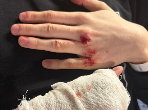 На красноярские травмпункты обрушилась сезонная волна пострадавших от самокатов. Фото: Красноярская краевая клиническая больница