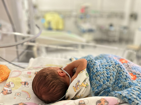 Крохотный малыш весом 580 граммов родился в Красноярске . Фото: ККК Центр охраны материнства и детства