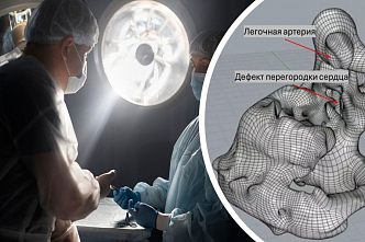 Красноярские врачи сделали редкую операцию с использованием 3D-модели и спасли двухмесячного малыша