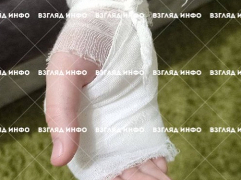 В Минусинске бродячая собака напала на троих школьников и покусала. Фото: Взгляд инфо/tg.me