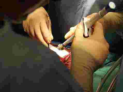 Уникальные сердечные клапаны научились вживлять красноярские хирурги через маленький разрез (фото). фото: krascor.ru