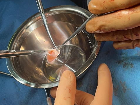 Красноярский кардиохирург прооперировал младенца с тяжелейшим пороком сердца в Иркутске. Фото: Министерство здравоохранения Иркутской области