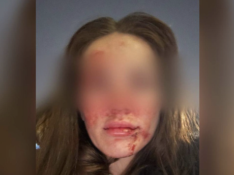 В Красноярске владельца стоматологии будут судить за истязание супруги. Фото: t.me/krpronws