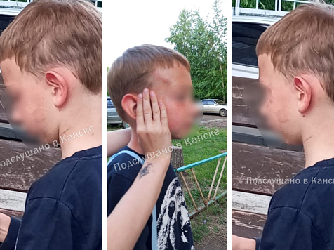 У матери, истязавшей своего шестилетнего сына в Канске, выявили психическое расстройство. Фото: «Подслушано в Канске» VK