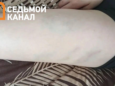 «Еле ходит»: мать избитого в Ачинске ребенка рассказала о состоянии мальчика. Фото: 7 канал Красноярск