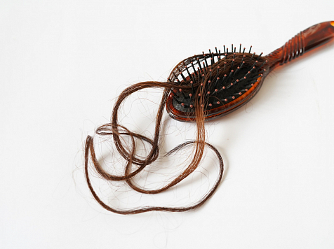 В красноярской краевой больнице рассказали о выпадении волос у пациентов с COVID-19. Фото: pixabay.com
