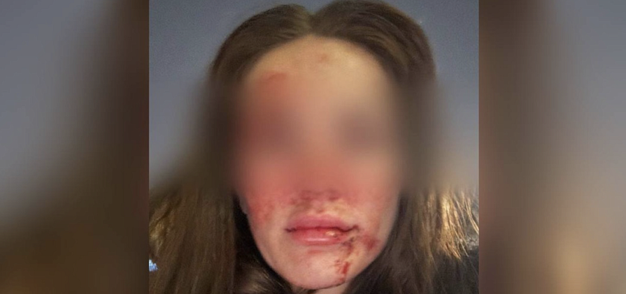 В Красноярске владельца стоматологии будут судить за истязание супруги