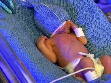 «Недоношенность — приговор?» В Красноярске родился мальчик весом 800 граммов. Фото: Минздрав Красноярского края