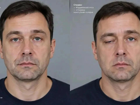 Красноярские врачи обнаружили у пациента редчайший синдром Ламберта-Итона. Фото: Красноярская МКБ № 20 имени И. С. Берзона