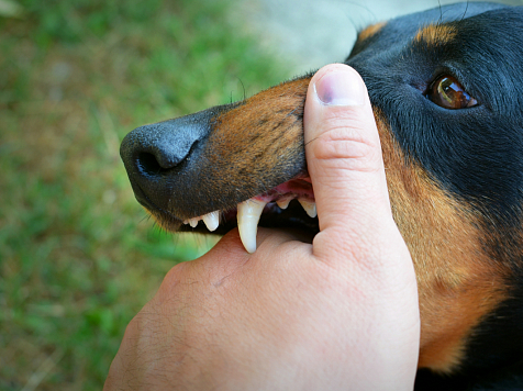С начала 2023 года собаки покусали красноярцев 756 раз. Фото: ru.freepik.com
